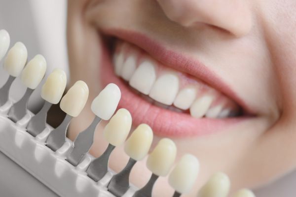 person smiling with tooth shade guide