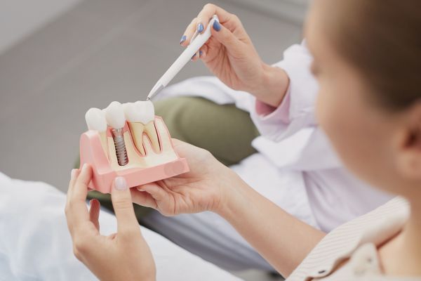 woman looking at a dental implant model