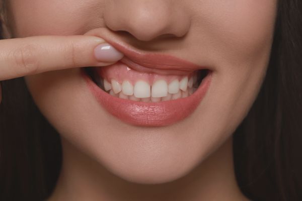 woman's teeth and gums