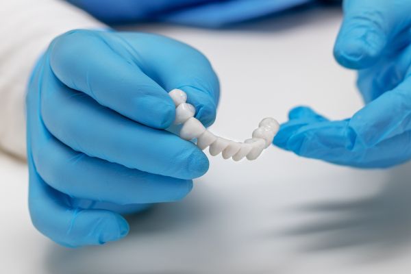 implant retained bridge